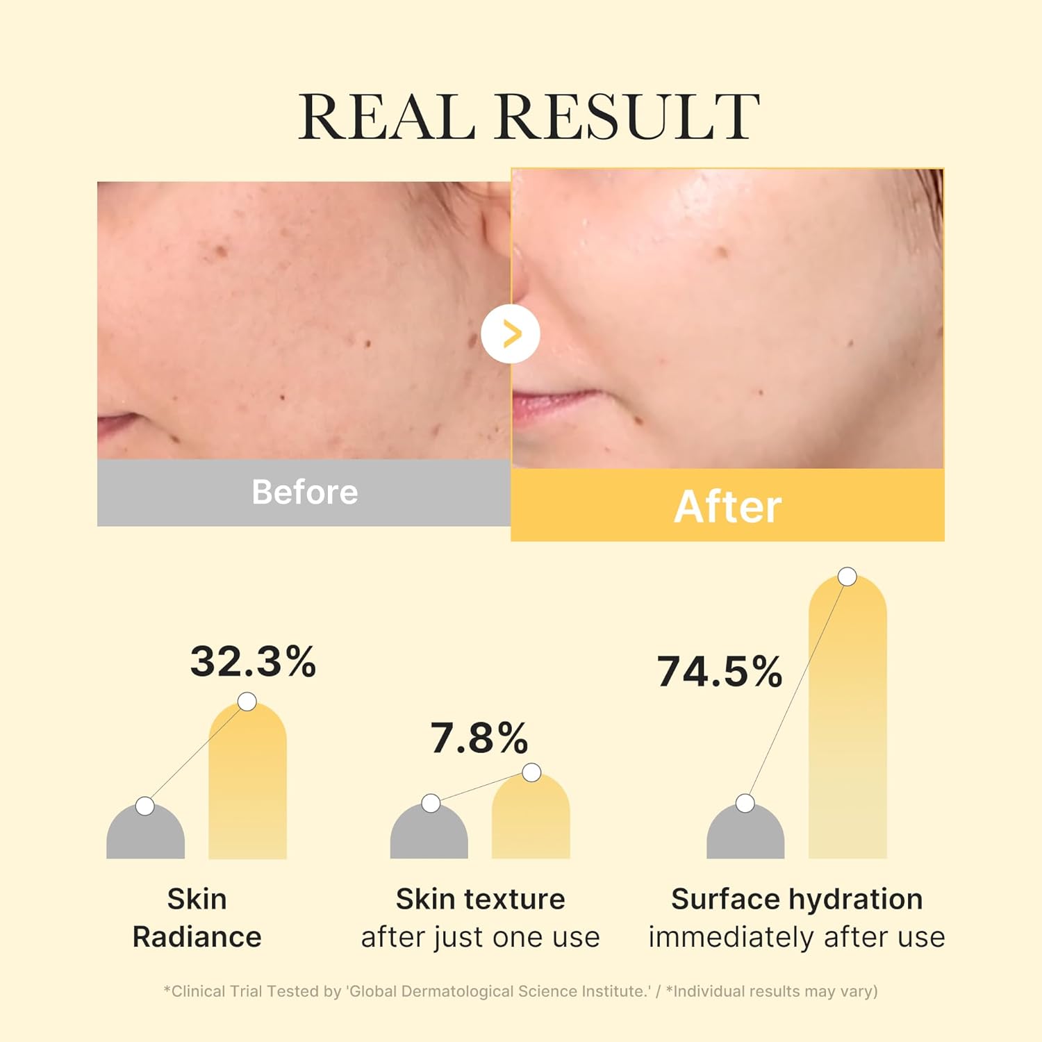 Kojic Acid & Turmeric Brightening Gel Mask - 4 feuilles